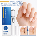 Tratamento para Unhas Remoção de Fungos nas Unhas - Caneta a Laser para Reparação das Unhas com Fungos - Indolor
