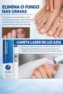 Tratamento para Unhas Remoção de Fungos nas Unhas - Caneta a Laser para Reparação das Unhas com Fungos - Indolor