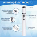 Tratamento para Unhas Remoção de Fungos nas Unhas - Caneta a Laser para Reparação das Unhas com Fungos - Indolor