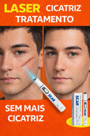 Dê Adeus à Cicatrizes - ScarRemoved Sistema a Laser na Segunda geração Elaborado para Solucionar Manchas e Cicatrizes na pele