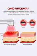 Aparelho de Terapia EasyTherapyWay  - Com luz vermelha para tratamento com LED infravermelho  para a Pele