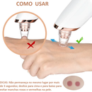 Removedor de Cravos e Peles Mortas VacuumUp - Aparelho aspirador removedor de peles mortas e cravos